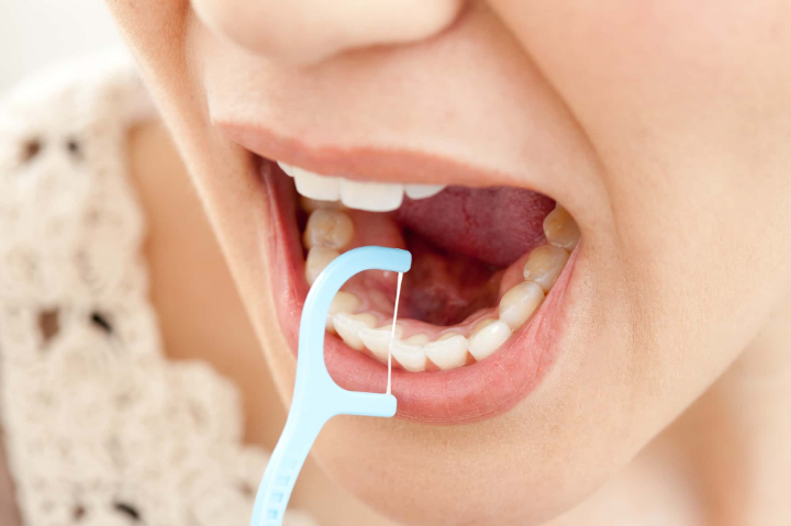 虫歯予防にフロスを使用するイメージ