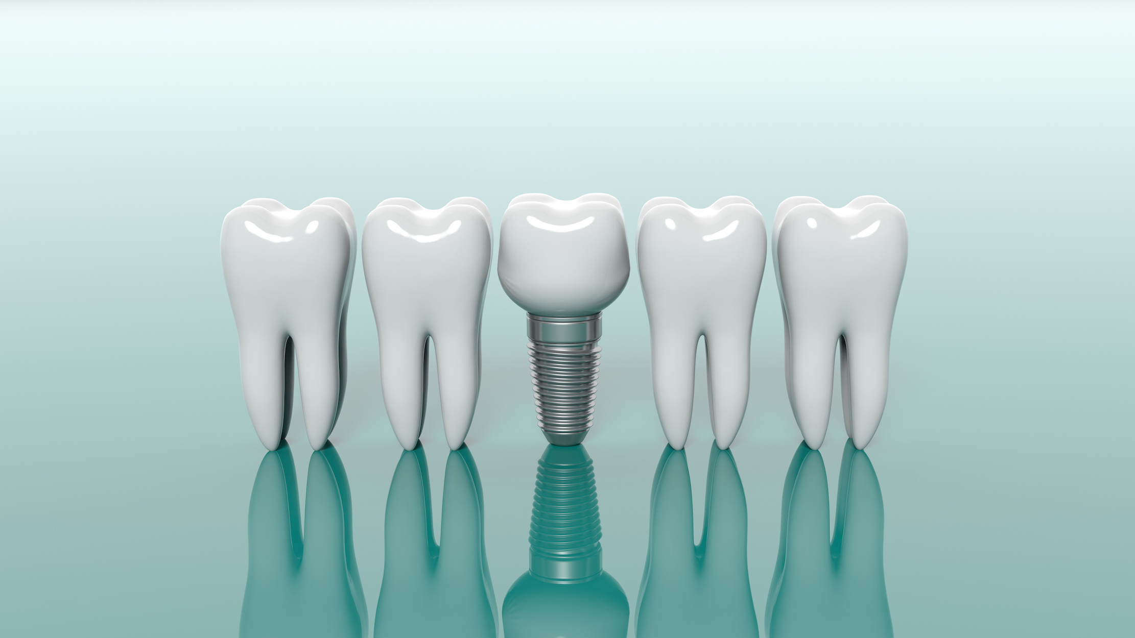 Teeth isolated on green background. 3d illustration