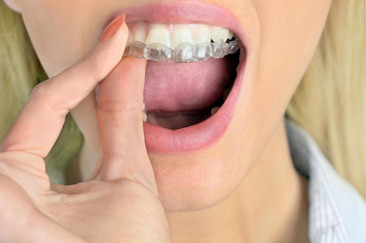 Woman with mouthguard