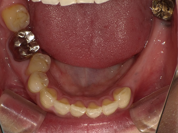 img-case02-bf