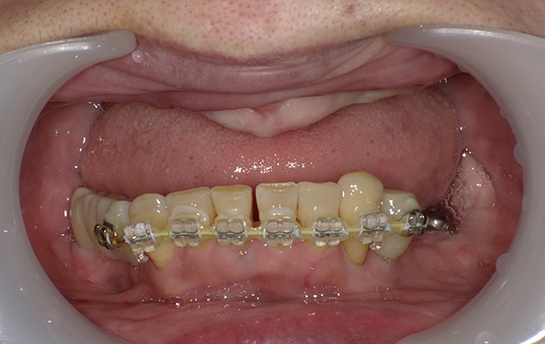 img-case04-bf