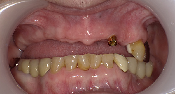 img-case06-bf