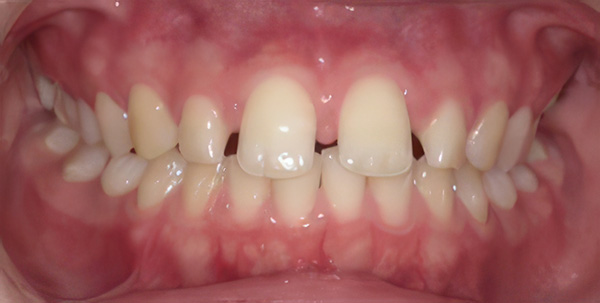 img-case12-bf