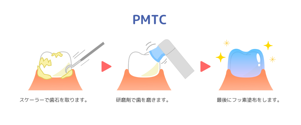 PMTCの流れのイメージ